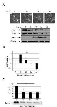 Figure 1: Spy1 protein levels are tightly regulated  during neuroblastoma progenitor fate decisions. 
