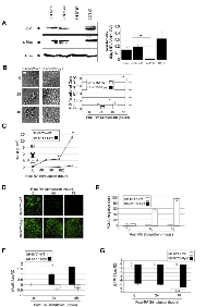 Figure 2:  Spy1 overexpression abrogates neuronal differentiation of neuroblastoma. 