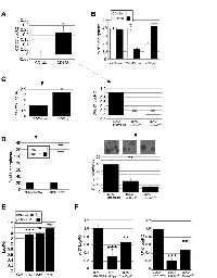 Figure 6:  Clonal properties of CD133+ populations of neuroblastoma depend on Spy1. 