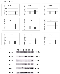 Figure 4:  Upregulation of Notch signaling pathway in the gallbladder of KC mice. (A) 