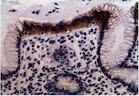 Figure 3A: Immunohistochemistry (IHC) staining of gastric-antral mucosa (positive control).