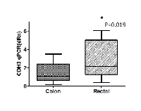 Figure 5:  CDH3 qPCR(dRn) colon tumors vs rectal  tumors.