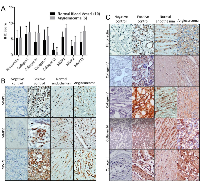 Figure 1: Expression of extracellular matrix components and their regulators in angiosarcoma and non-diseased  endothelial tissues. 