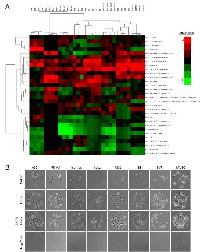 Figure 2:  Extracellular matrix attachment preference of angiosarcoma cells.  