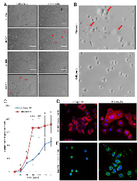 Figure 3:  Timing of angiosarcoma cell adhesion to extracellular matrix substrates.  