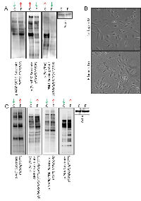 Figure 4:  Extracellular matrix-mediated changes in intracellular signaling.  