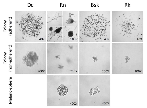 Figure 1: Colonies morphology under adherent and non-adherent (in soft agar) conditions and melanosphere  morphology. 