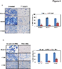 Figure 4:  Inhibition of FAK decreases the invasive property of lung cancer cells. 