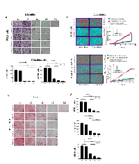 Figure 6:  Migration, chemotaxis and invasiveness of tumor cells co-incubated with plasma exosomes obtained from  HNSCC patients undergoing PDT. 