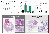 Figure 2:  LBH589 suppresses tumorigenesis and metastasis <i>in vivo</i> using CL-TNBC PDX model.  (A) 