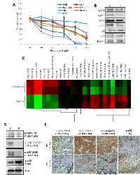 Figure 1: β-AR antagonism inhibits angiosarcoma viability and mitogenic/survival signaling.  (A) 