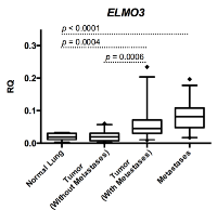Figure 1: ELMO3 expression in NSCLC. 
