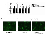 Figure 5:  Resminostat reduced metastatic progression in HCC under SGBS CM treatment.  (A) 