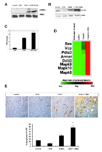 Figure 3:  LOFU+17AAG activates pro-apoptotic  pathways of UPR and induces apoptosis in tumor  cells. 