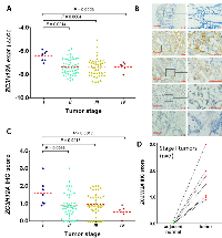 Figure 4:  Examination of ZC3H12A expression in the CRC patient cohort at Zhongshan Hospital, Shanghai.  (A) 