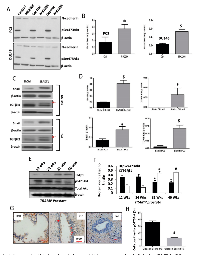 FIGURE 8:  A decrease in Akt phosphorylation (activity), not expression is linked to EMT in PCa.  (A) 