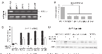 Figure 3:  Ectopic expression of miR-125B suppresses SAF-1 mRNA and protein levels in breast cancer cells. 