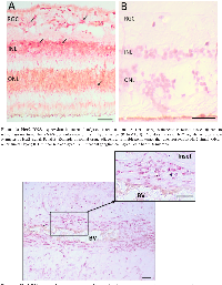 Figure 3:  Her2 RNA expression in normal adjacent retina. 