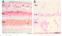 Figure 4:  Her2 RNA expression in optic nerve of tumor-bearing eye. 