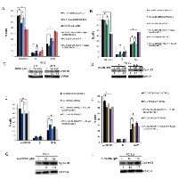 Figure 3:  Treatment with AICAR or A-769662 induced G2/M arrest in PC3 and PC3M cells and cyclin B1 accumulation. 