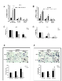 Figure 4:  Treatment with AICAR suppressed migration and invasion in PC3 and PC3M cells. 