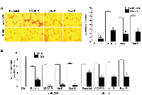 Figure 3:  Overexpressed miR-145 decreases formation of capillary-like tubes by HUVECs and migration in  neuroblastoma cells. 