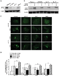 Figure 4:  Overexpressed miR-145 increases LC3 I & II protein levels in neuroblastoma cells. 