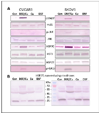 Fig  2:  Activation  of  apoptosis  and  the  heat  shock  response  by  disulfiram/copper. 