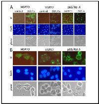 Fig 5:  Subcellular localization of heat shock proteins  in  response  to  disulfiram/copper. 