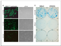 Fig  6:  Short  term  disulfiram/copper  treatment  causes  irreversible  cell  damage,  associated  with  cell  detachment  and  actin  fiber  depolymerization. 