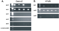 Figure 3:  Sst mRNA expression on Caco-2 (A) and HT-29 (B) cells using RT-PCR. 