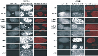 Figure 4:  Immunocytochemistry for somatostatin receptors on Caco-2 and HT-29 cells. 