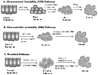 Figure 1: Multiple genetic pathways in colorectal cancer pathogenesis. 