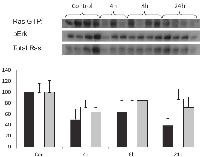 Fig 4:  Inhibition of Ras in tumors affects Ras and  pERK levels after a single dose of FTS. 