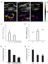 Fig 5:  Effects of Ras on HGF/SF-induced changes  in tumor blood volume. 