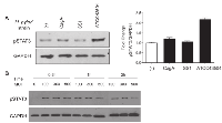 Figure 1: STAT3 was activated in H. pylori ATCC43504 infected AGS cells. 