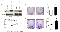 Figure 3: STAT3 processes oncogenic function in gastric cancer cells. 