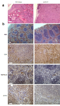 Figure 3:  Immunohistochemistry analysis in B16  grafted tumor and host spleen. 