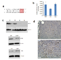 Figure 4:  MiR-17 targets STAT3 in tumor stromal  cells. 