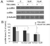 Figure 3:  ROCK inhibitor Y-27632 mask T56-LIMKi  inhibition  of  cofilin  phosphorylation. 