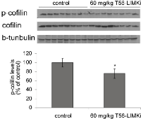 Figure 7:  T56-LIMKi reduces p-cofilin levels in Panc1- cell xenografts in a nude mouse model. 
