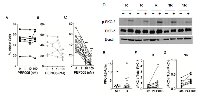 Figure 3:  PEP005 treatment leads to the activation of PKC-δ in both responsive and non-responsive patient samples. 
