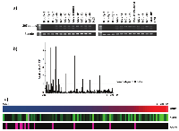 Figure 1:  mrnA expression a) nAPePld in non-malignant B-cells and Mcl analyzed by rt-Pcr; b) FAAH mrnA  in Mcl analyzed by qPcr and expressed as relative fold increase (rFI) compared to non-malignant B cells; c)  expression of cnr1, cnr2 and FAAH in Mcl. 