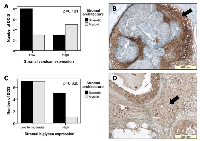 Figure 3:  Comparison of stromal versican and biglycan expression in DCIS lesions with sclerotic or myxoid stroma. 