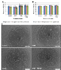 Figure 8:  Adhesion assays with T47D cells seeded onto CAF-derived matrices. 