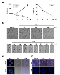 Figure 1: Edelfosine promotes rapid cell death in U118  human glioma cells. 
