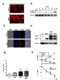 Figure 3:  Induction of autophagy in edelfosine-treated U118 cells. 