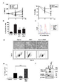 Figure 5:  Induction of Nec-1-inhibitable necrosis in edelfosine-treated U118 cells. 