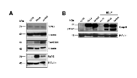 Figure 6:  Relative protein levels of RIPK1, Fas/CD95, FADD and procaspase-8 in U118, HeLa and Jurkat cells. 