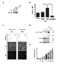 Figure 7:  Effect of RIPK3 silencing on edelfosine-induced cell death in U118 cells. 